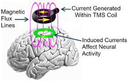 Understanding Magnetic Therapy
