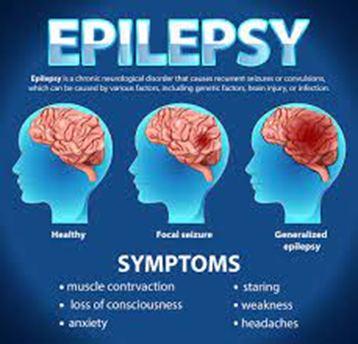 The Epilepsy Solution: Pathways to Control and Care
