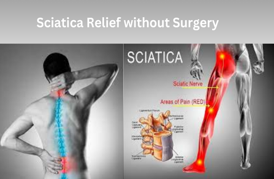 Sciatica Relief without Surgery: Holistic Methods & Therapies