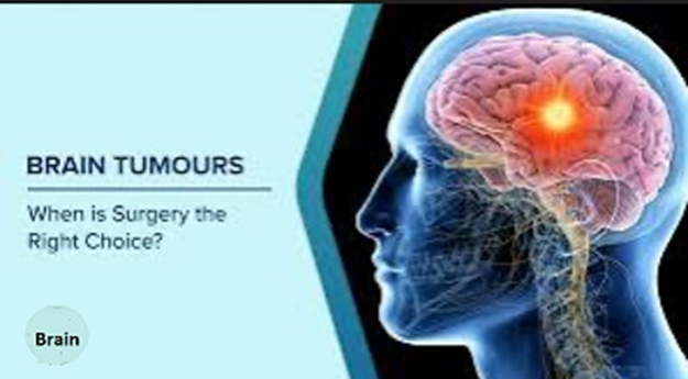 Brain Tumors in Players: A Factual Guide to Trauma and Recovery