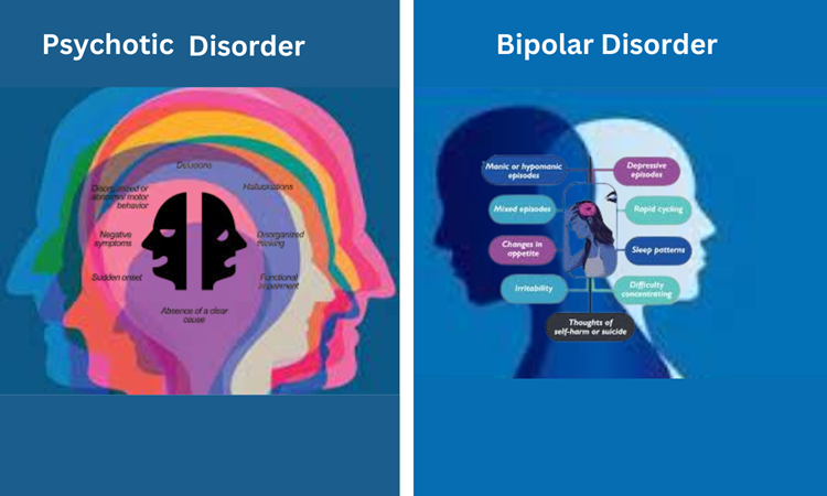 Neural Correlates of Psychosis in Bipolar Disorder: A Guide for Treatment