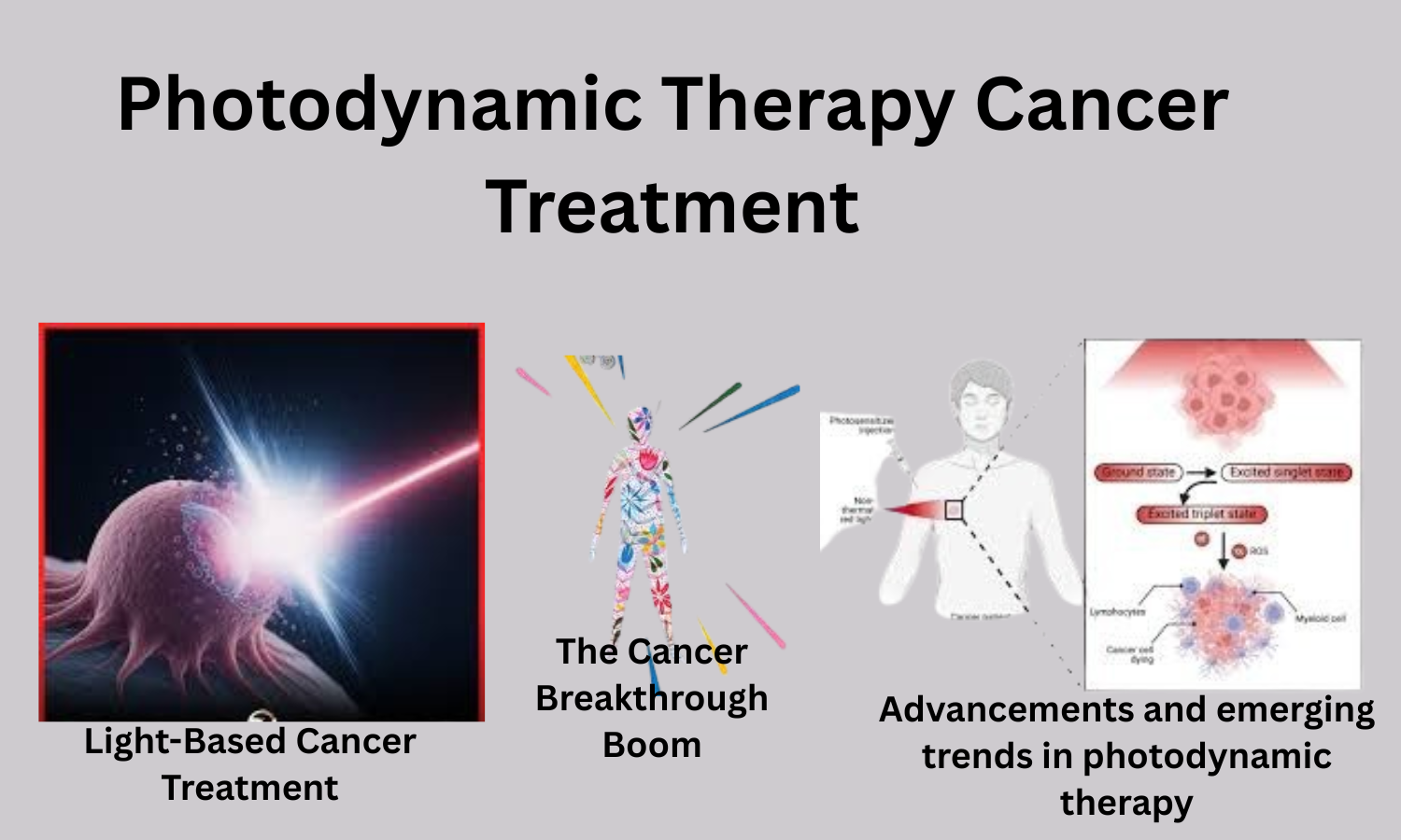 Photodynamic Therapy Cancer Treatment: A Breakthrough Without Chemo.