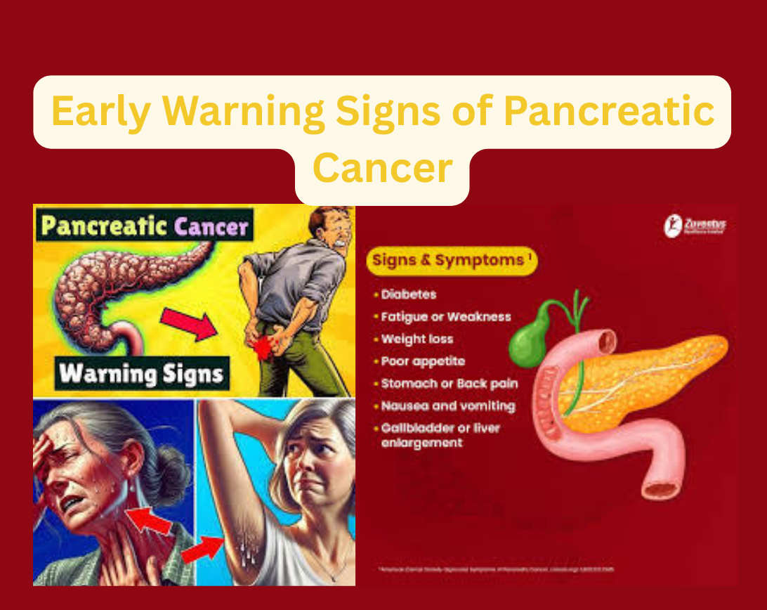 Early Warning Signs of Pancreatic Cancer in the Blood 