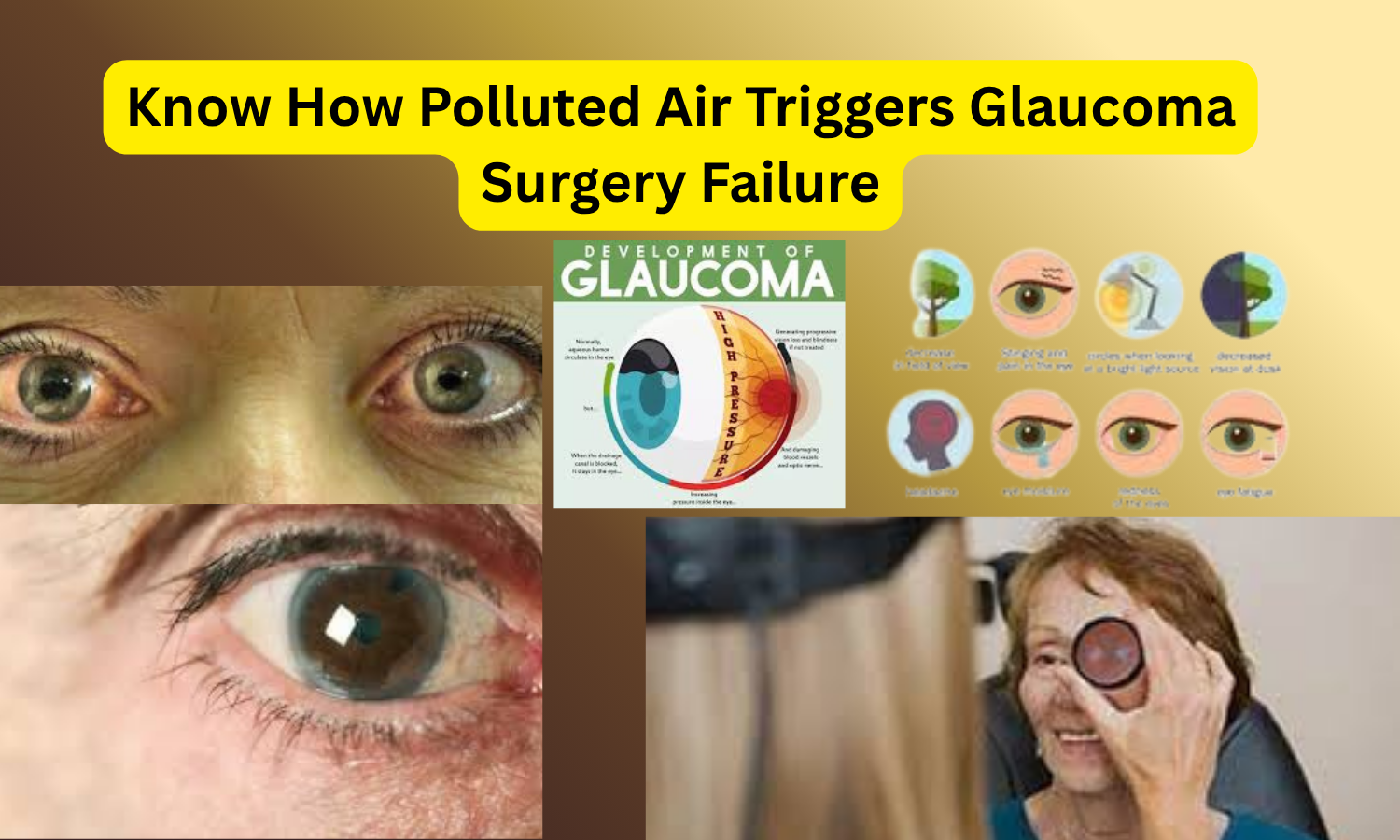Know How Polluted Air Triggers Glaucoma Surgery Failure
