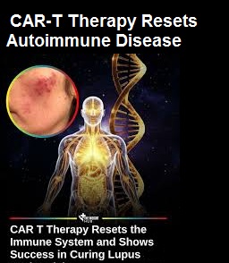 How CAR-T Therapy Resets Autoimmune Diseases •