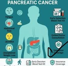 pancreatic cancer