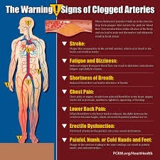 Causes of Blocked Arteries