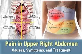 Right Upper Abdominal Pain
