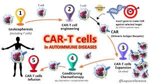 Autoimmune diseases