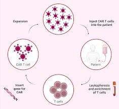 CAR-T Therapy and Lupus