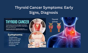 Thyroid Cancer Symptoms: Early Signs, Diagnosis & Treatment