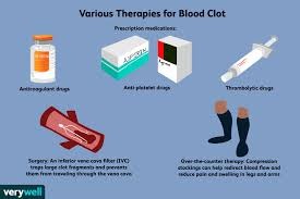 Treatment Options